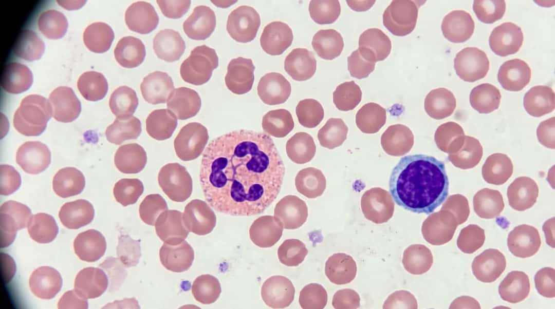 Identification of Human Blood Cells in Peripheral Smear